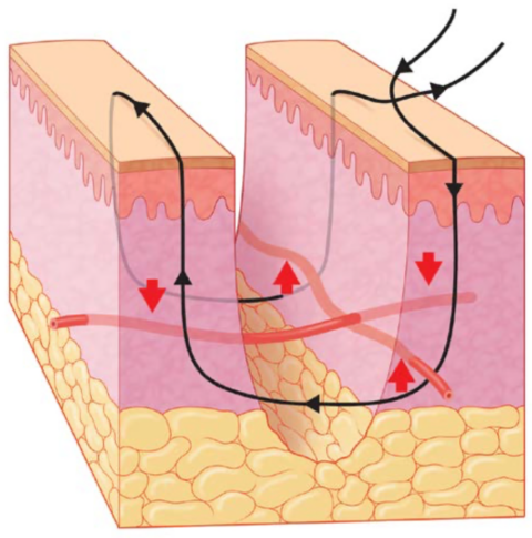 Mattress | Suture.app